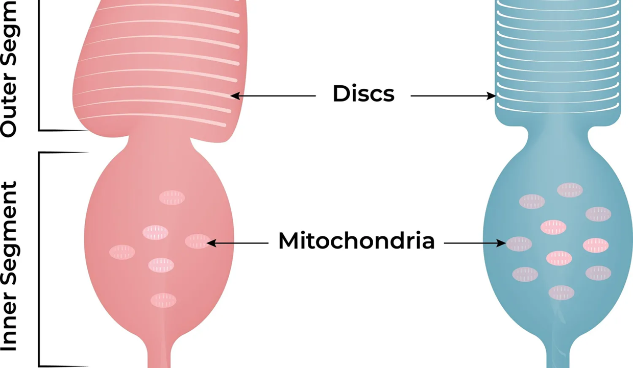 האור בקצה המנהרה: טיפולים למחלות רשתית תורשתיות