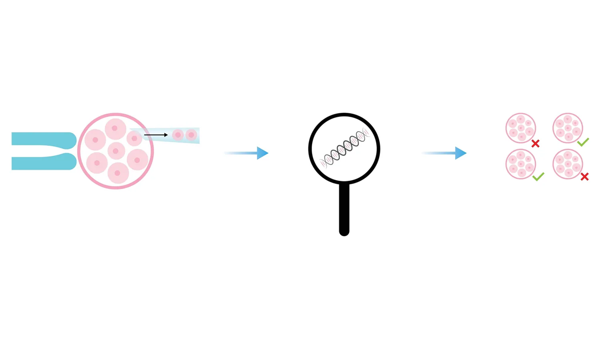 הגנטיקה בשירות מחלות העיניים